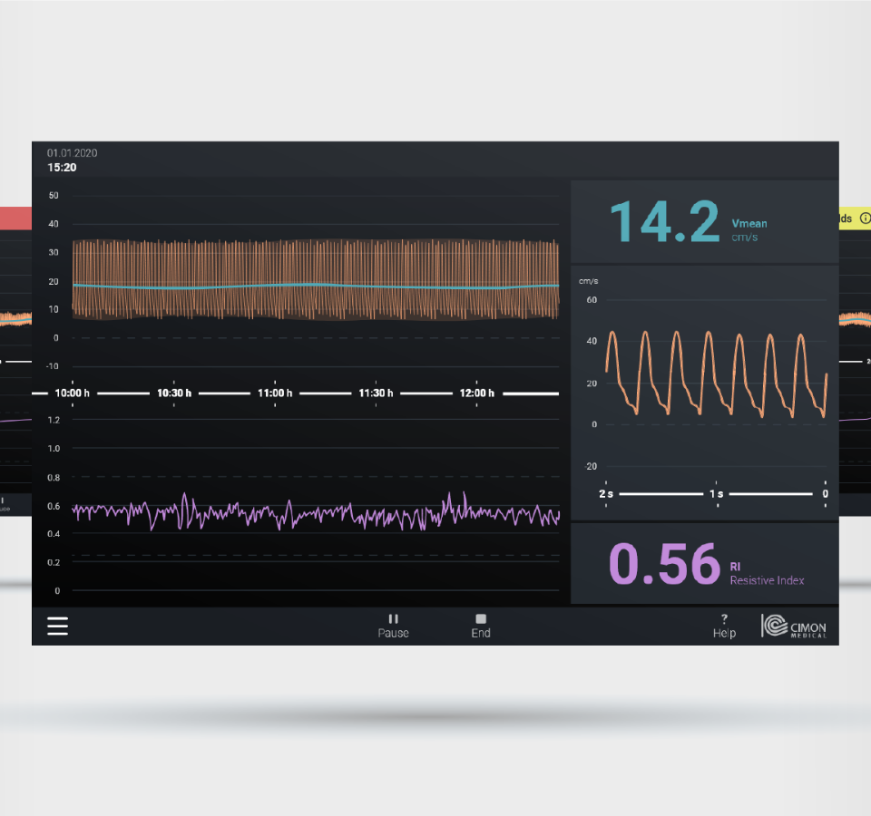 Das Interface Design des NeoDoppler in der Frontansicht.